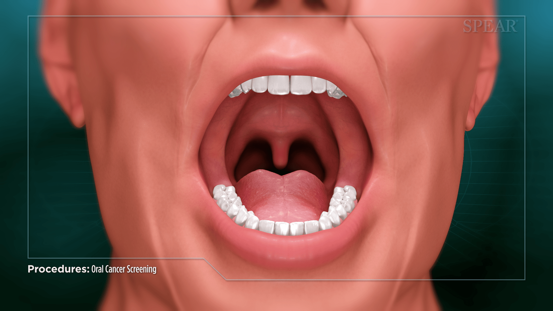 oral cancer screening 09